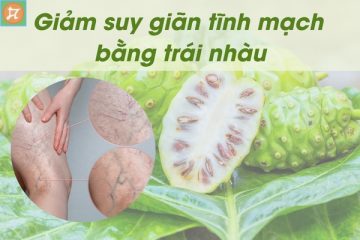 giam suy gian tinh mach hieu qua bang trai nhau