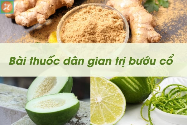 4. Vai Trò Của Dinh Dưỡng Trong Điều Trị Bướu Cổ