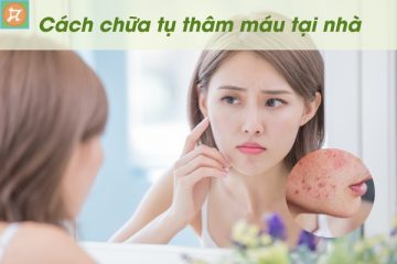 cach chua tham tu mau hieu qua tai nha